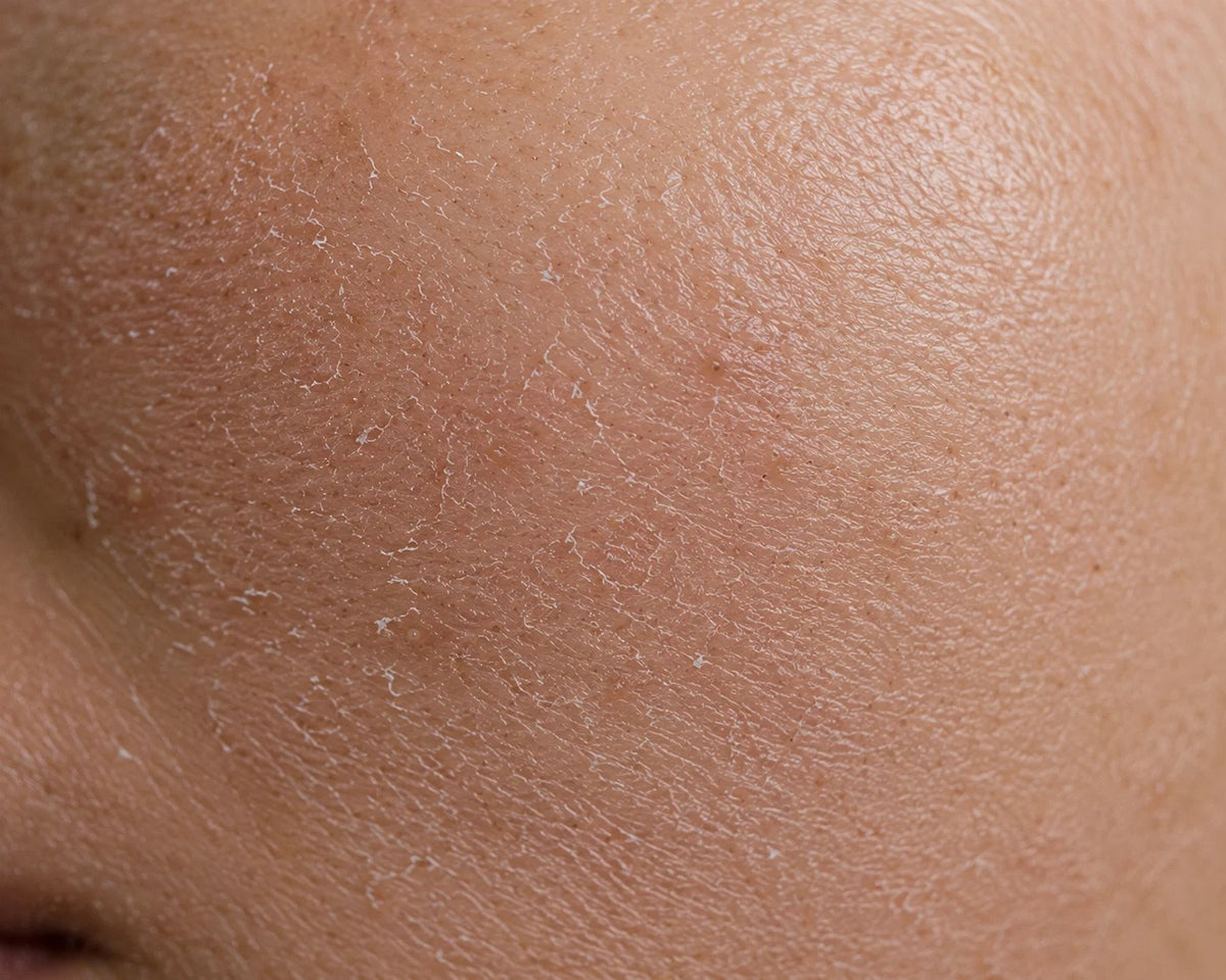 Dry & Dull Skin Solutions